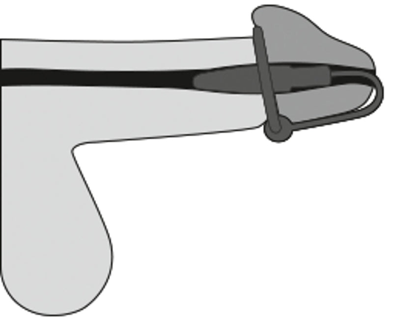 Penisplug Eikelring met dilator - Paars