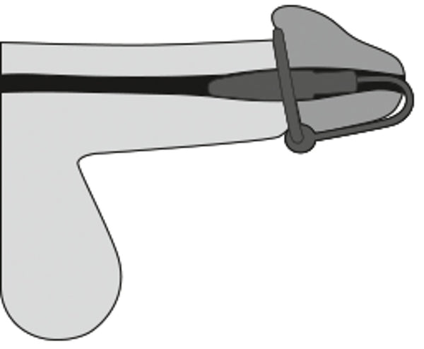 Penisplug Eikelring met dilator - Paars - Penisplug - SKU: 5177040000