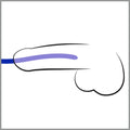 You2Toys Dilator set - Blauw