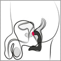 Rebel Prostatevibrator - Zwart